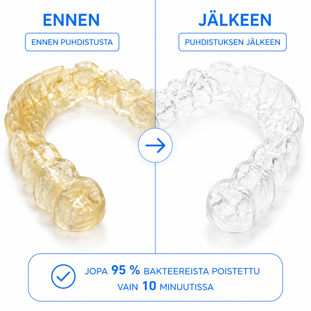 DENTAFRESH – BAKTEERITON PURENTAKISKO 10 MINUUTISSA