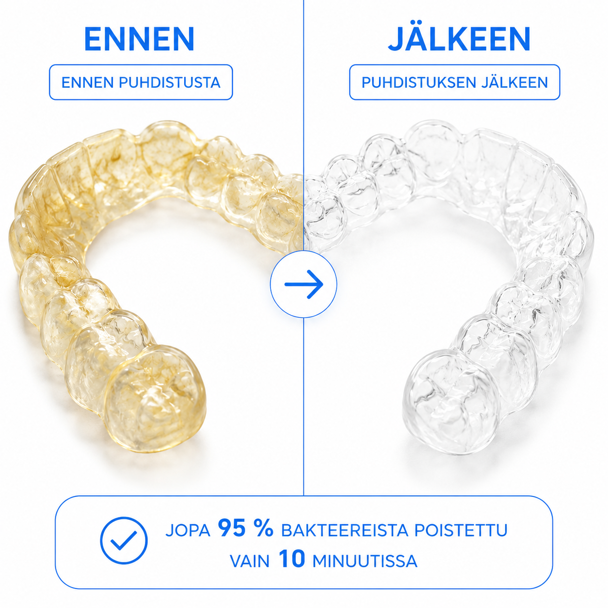 DENTAFRESH – BAKTEERITON PURENTAKISKO 10 MINUUTISSA